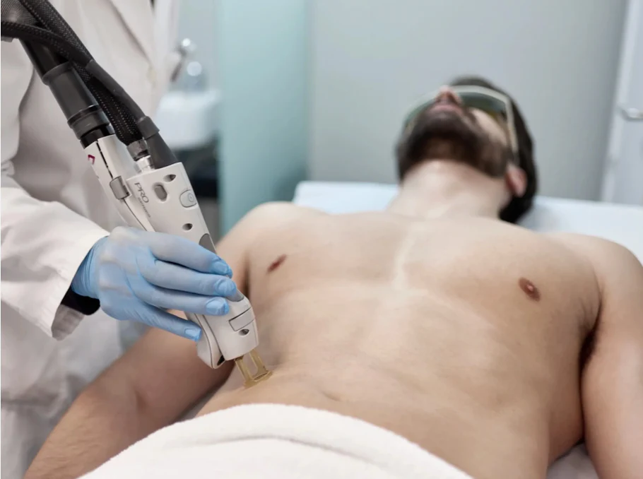 Abdomen Laser
