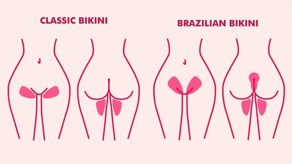 Brazilian + Perianal Laser Hair Removal Doha