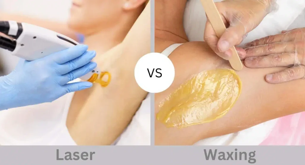 Laser Hair Removal Cost In Doha vs Waxing